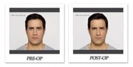 Stop (Okay, Slow Down) the Facial Aging Process