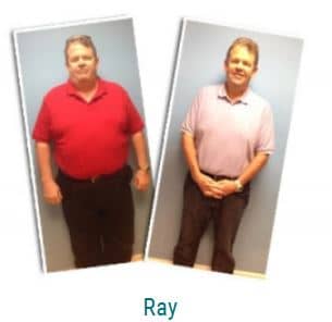 gastric-sleeve-and-testosterone